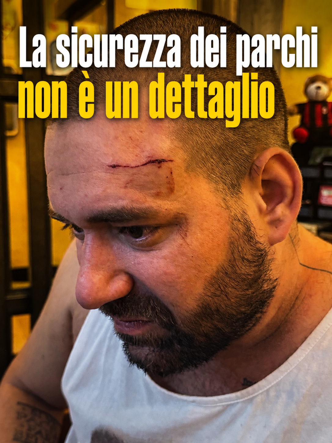 Nazareno Tazzi, aggredito con un tirapugni al parco Wanda Osiris, mostra la ferita alla fronte.